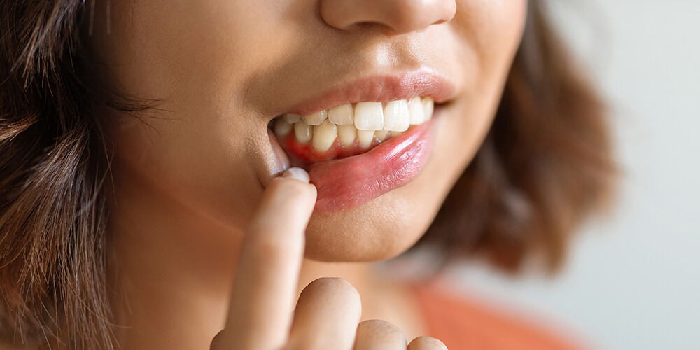 Periodontal Therapy Edmonton