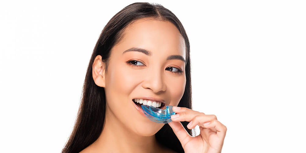 TMD/Bruxism Night Guards Edmonton