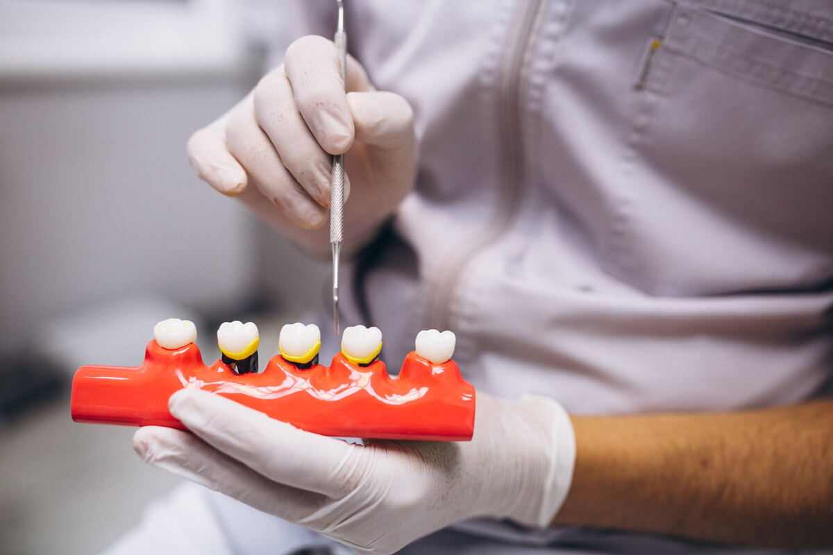 What are the 4 Steps of Periodontal Treatment?