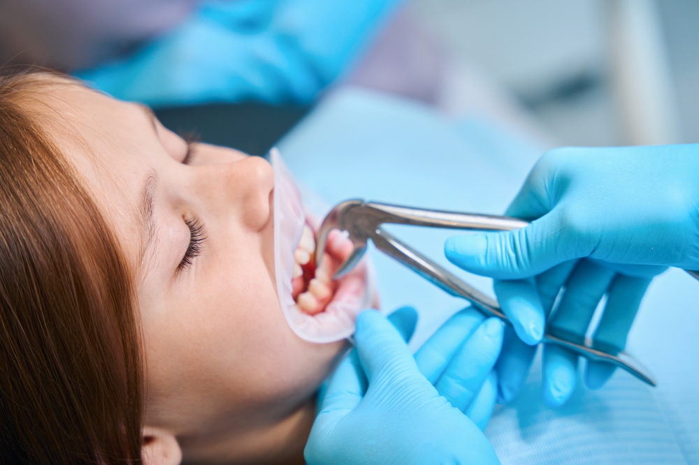 Tooth Extraction Necessary Teeth Replacement Options